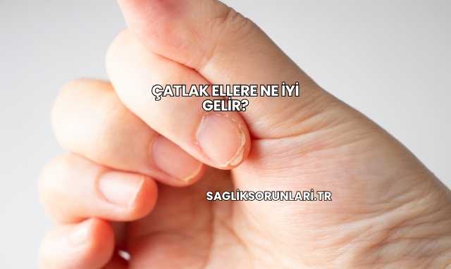 Çatlak Ellere Ne İyi Gelir?