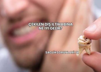 Çekilen Diş İltihabına Ne İyi Gelir?