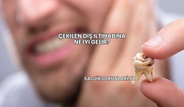 Çekilen Diş İltihabına Ne İyi Gelir?