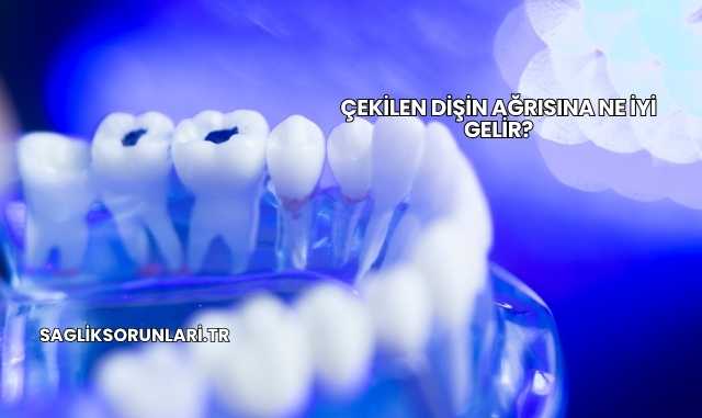 Çekilen Dişin Ağrısına Ne İyi Gelir?