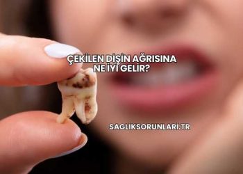 Çekilen Dişin Ağrısına Ne İyi Gelir?