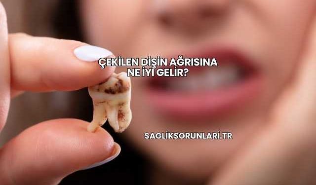 Çekilen Dişin Ağrısına Ne İyi Gelir?