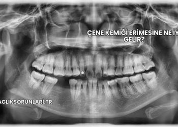 Çene Kemiği Erimesine Ne İyi Gelir?