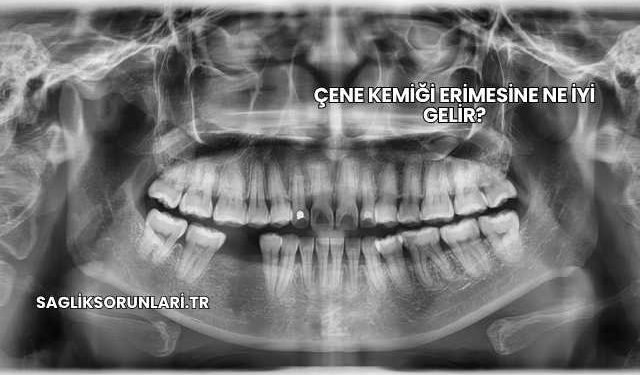 Çene Kemiği Erimesine Ne İyi Gelir?