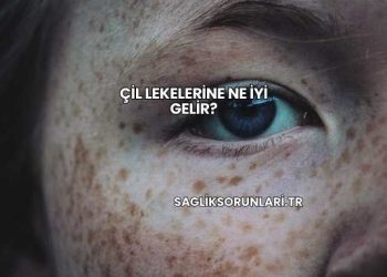 Çil Lekelerine Ne İyi Gelir?