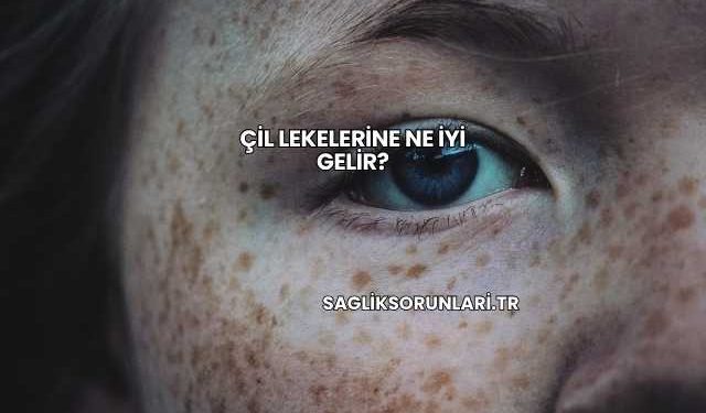 Çil Lekelerine Ne İyi Gelir?