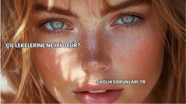 Çil Lekelerine Ne İyi Gelir?