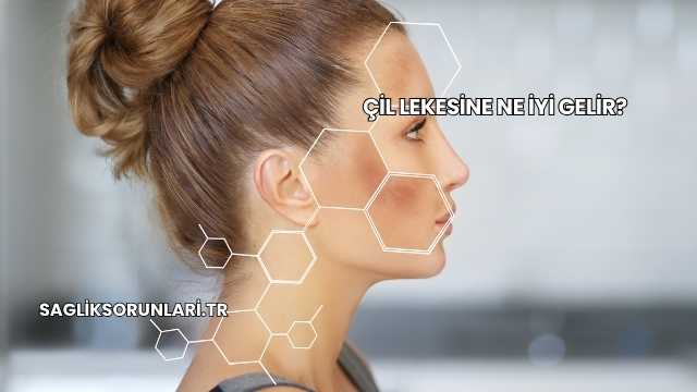Çil Lekesine Ne İyi Gelir?
