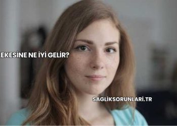 Çil Lekesine Ne İyi Gelir?