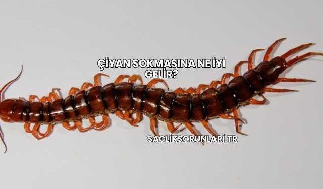 Çiyan Sokmasına Ne İyi Gelir?