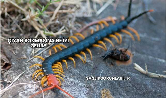 Çiyan Sokmasına Ne İyi Gelir?