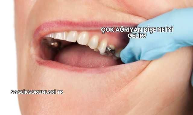 Çok Ağrıyan Dişe Ne İyi Gelir?
