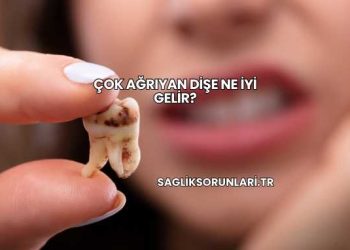 Çok Ağrıyan Dişe Ne İyi Gelir?