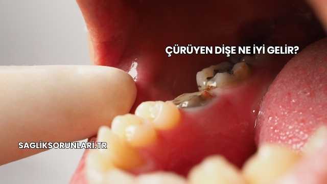 Çürüyen Dişe Ne İyi Gelir?