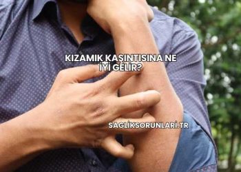 Kızamık Kaşıntısına Ne İyi Gelir?