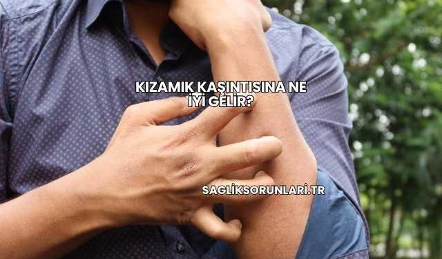 Kızamık Kaşıntısına Ne İyi Gelir?