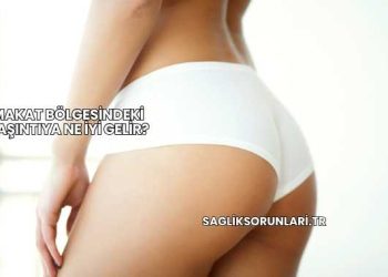 Makat Bölgesindeki Kaşıntıya Ne İyi Gelir?