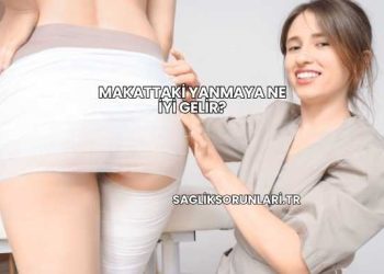 Makattaki Yanmaya Ne İyi Gelir?