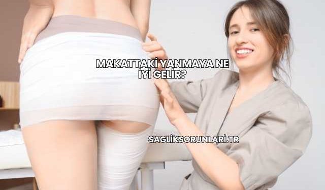 Makattaki Yanmaya Ne İyi Gelir?