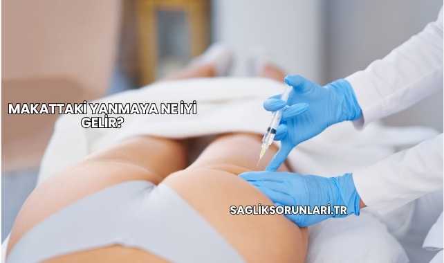 Makattaki Yanmaya Ne İyi Gelir?