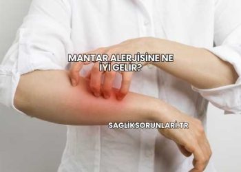 Mantar Alerjisine Ne İyi Gelir?
