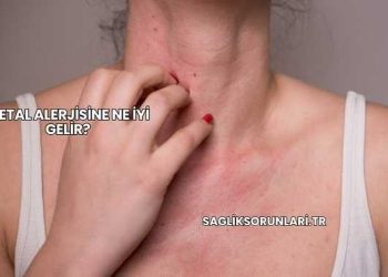 Metal Alerjisine Ne İyi Gelir?