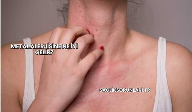 Metal Alerjisine Ne İyi Gelir?