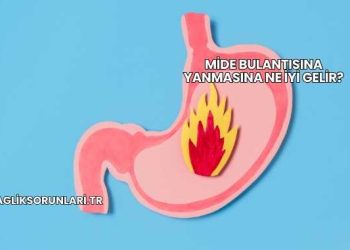Mide Bulantısına Yanmasına Ne İyi Gelir?