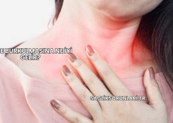 Mide Burkulmasına Ne İyi Gelir?