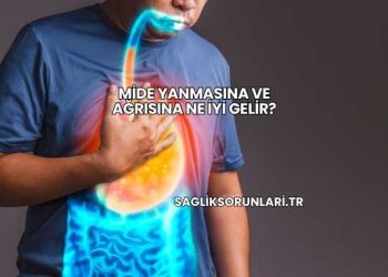 Mide Yanmasına ve Ağrısına Ne İyi Gelir?