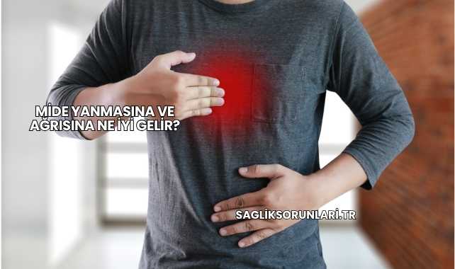 Mide Yanmasına ve Ağrısına Ne İyi Gelir?