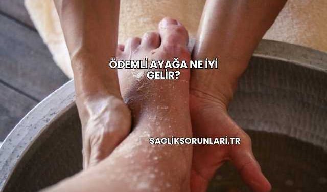 Ödemli Ayağa Ne İyi Gelir?