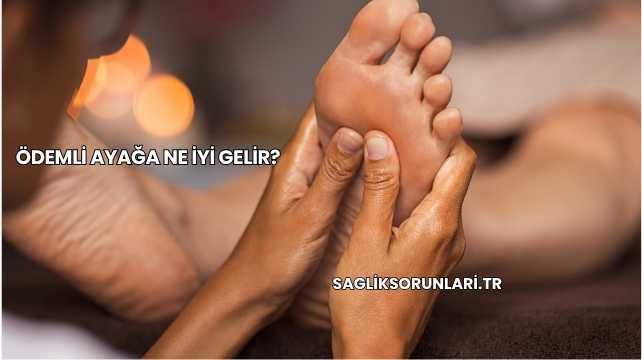 Ödemli Ayağa Ne İyi Gelir?