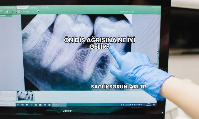 Ön Diş Ağrısına Ne İyi Gelir?