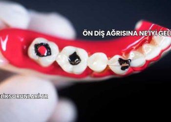 Ön Diş Ağrısına Ne İyi Gelir?