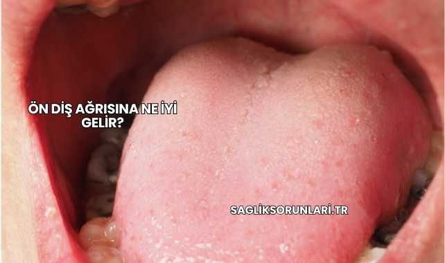 Ön Diş Ağrısına Ne İyi Gelir?