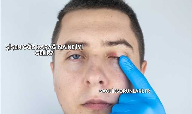 Şişen Göz Kapağına Ne İyi Gelir?