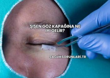 Şişen Göz Kapağına Ne İyi Gelir?