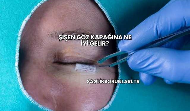 Şişen Göz Kapağına Ne İyi Gelir?