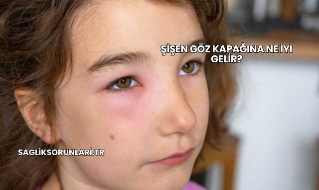 Şişen Göz Kapağına Ne İyi Gelir?