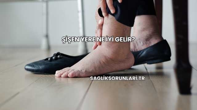 Şişen Yere Ne İyi Gelir?