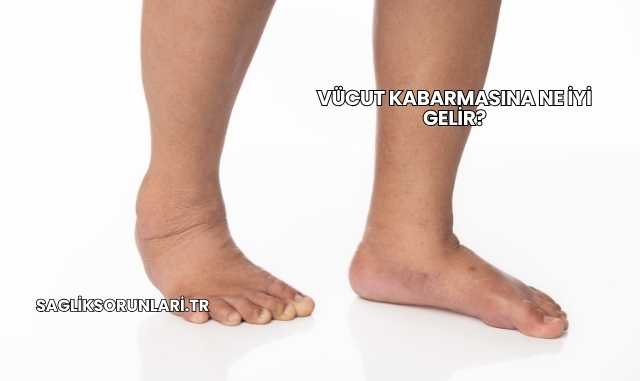 Vücut Kabarmasına Ne İyi Gelir?