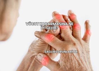 Vücut Kabarmasına Ne İyi Gelir?