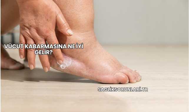 Vücut Kabarmasına Ne İyi Gelir?