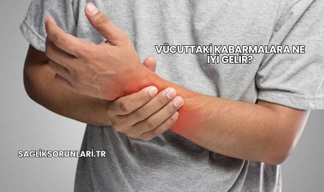Vücuttaki Kabarmalara Ne İyi Gelir?