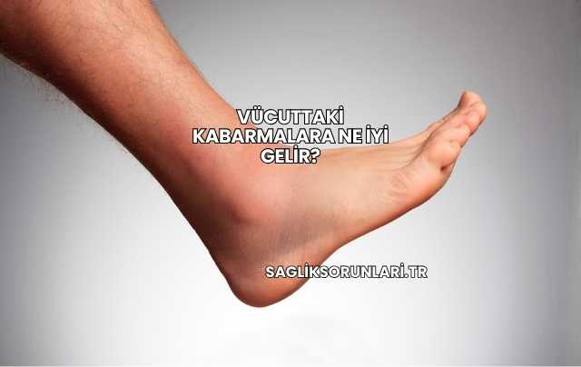 Vücuttaki Kabarmalara Ne İyi Gelir?
