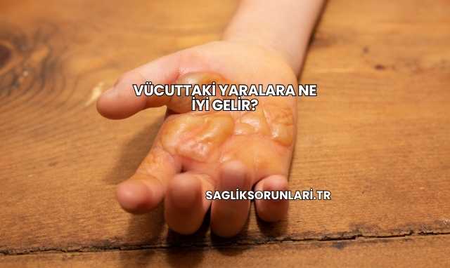 Vücuttaki Yaralara Ne İyi Gelir?