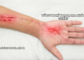 Vücuttaki Yaralara Ne İyi Gelir?