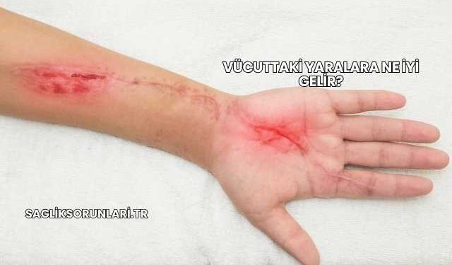 Vücuttaki Yaralara Ne İyi Gelir?