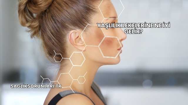 Yaşlılık Lekelerine Ne İyi Gelir?